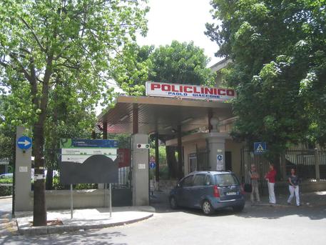 Vaiolo scimmie: negativo paziente ricoverato a Palermo dal 24 maggio
